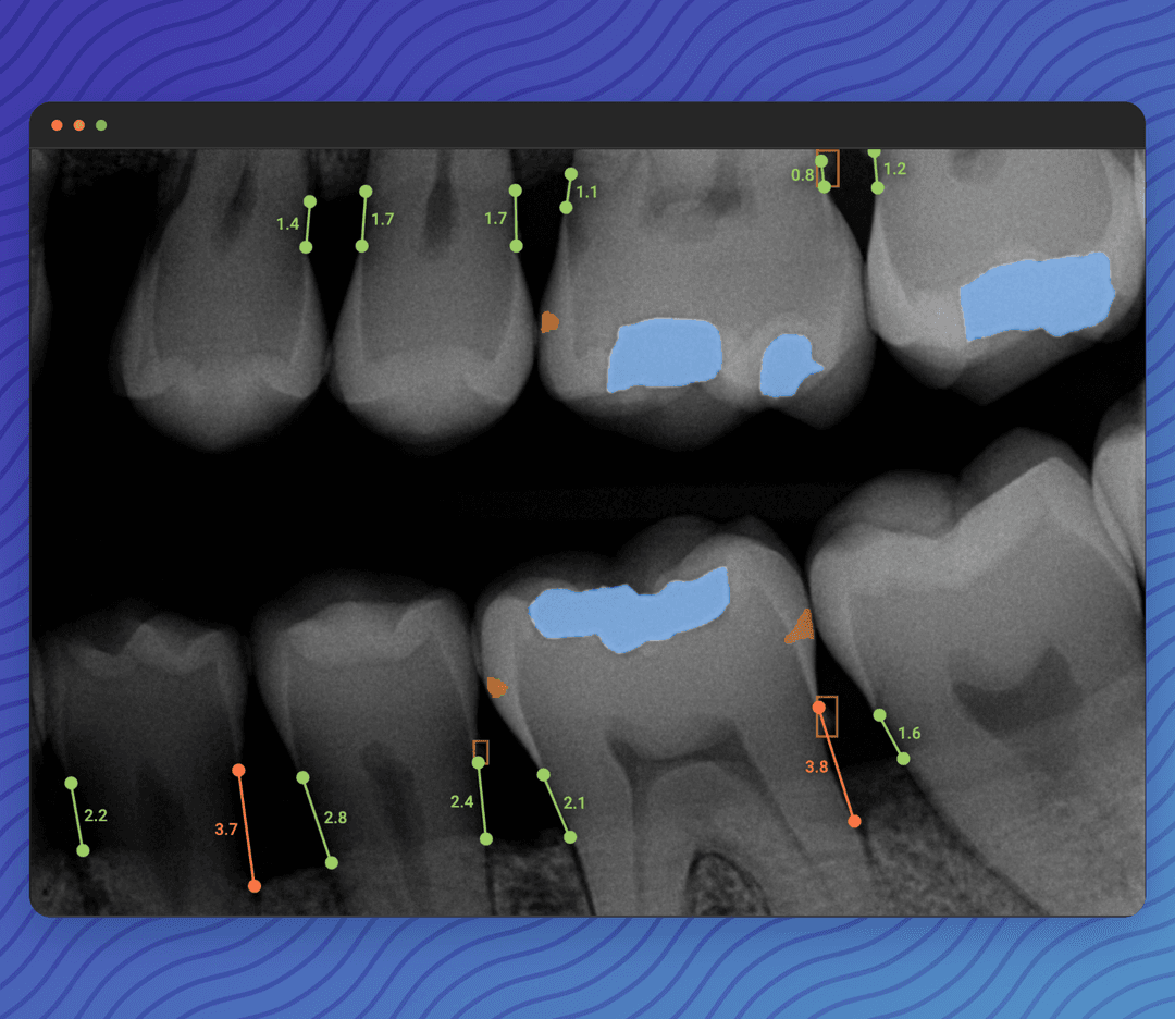 Dentapp AI X-Ray POC